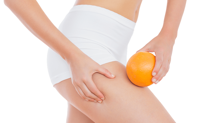 Slimming & Anti-Cellulite Cream