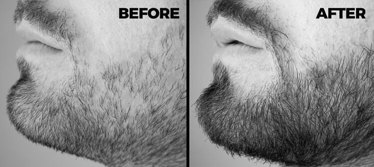 Beard Booster